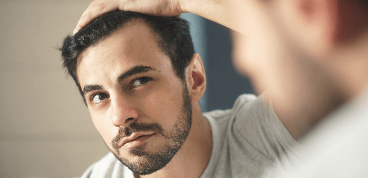 Queda de Cabelo: causas e tratamentos